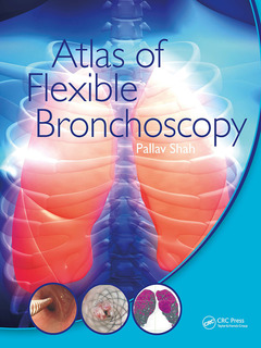 Couverture de l’ouvrage Atlas of Flexible Bronchoscopy