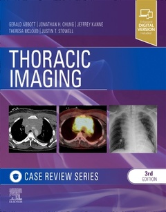 Couverture de l’ouvrage Thoracic Imaging: Case Review