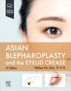 Cover of the book Asian Blepharoplasty and the Eyelid Crease