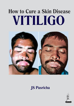 Couverture de l’ouvrage How to Cure a Skin Disease: Vitiligo