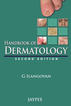 Couverture de l’ouvrage Handbook of Dermatology