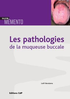 Couverture de l’ouvrage Les pathologies de la muqueuse buccale