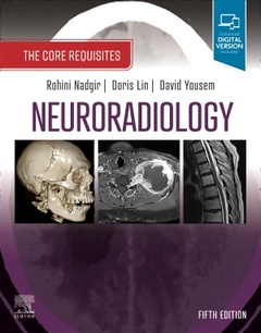 Couverture de l’ouvrage Neuroradiology