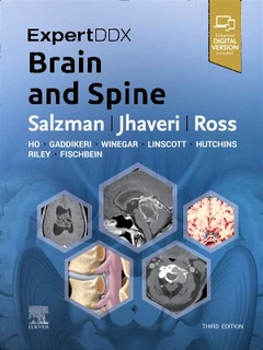 Couverture de l’ouvrage ExpertDDx: Brain and Spine