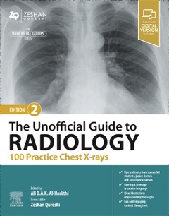 Couverture de l’ouvrage The Unofficial Guide to Radiology: 100 Practice Chest X-rays