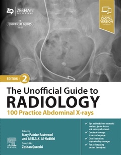 Couverture de l’ouvrage The Unofficial Guide to Radiology: 100 Practice Abdominal X-rays