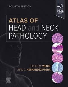 Couverture de l’ouvrage Atlas of Head and Neck Pathology