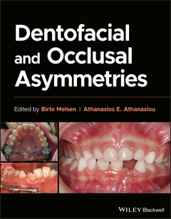 Couverture de l’ouvrage Dentofacial and Occlusal Asymmetries
