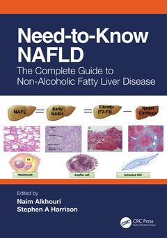 Couverture de l’ouvrage Need-to-Know NAFLD