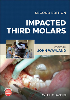 Couverture de l’ouvrage Impacted Third Molars