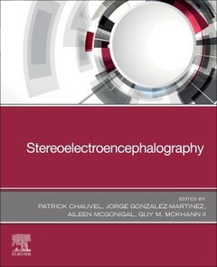 Couverture de l’ouvrage The Fundamentals of Stereoelectroencephalography