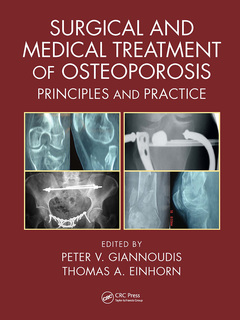 Couverture de l’ouvrage Surgical and Medical Treatment of Osteoporosis
