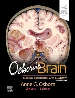 Couverture de l’ouvrage Osborn's Brain