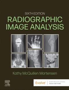 Couverture de l’ouvrage Radiographic Image Analysis
