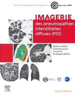 Couverture de l’ouvrage Imagerie des pneumopathies interstitielles diffuses (PID)