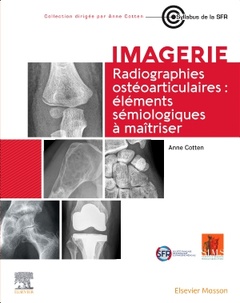 Couverture de l’ouvrage Radiographies ostéoarticulaires : éléments sémiologiques à maitriser