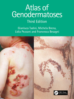Couverture de l’ouvrage Atlas of Genodermatoses