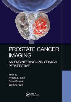 Couverture de l’ouvrage Prostate Cancer Imaging