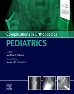 Couverture de l’ouvrage Complications in Orthopaedics: Pediatrics