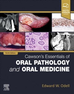 Couverture de l’ouvrage Cawson's Essentials of Oral Pathology and Oral Medicine
