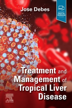 Couverture de l’ouvrage Treatment and Management of Tropical Liver Disease