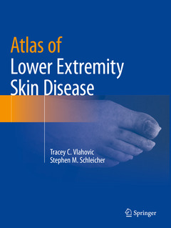 Couverture de l’ouvrage Atlas of Lower Extremity Skin Disease