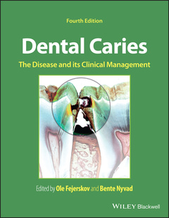 Couverture de l’ouvrage Dental Caries