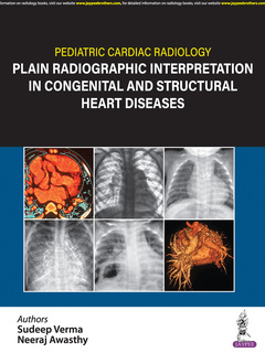 Couverture de l’ouvrage Pediatric Cardiac Radiology
