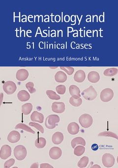 Couverture de l’ouvrage Haematology and the Asian Patient