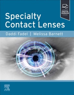 Couverture de l’ouvrage Specialty Contact Lenses