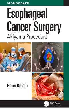 Couverture de l’ouvrage Esophageal Cancer Surgery