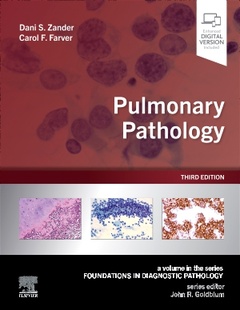Cover of the book Pulmonary Pathology