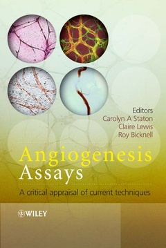 Couverture de l’ouvrage Angiogenesis Assays: A Critical Appraisal of Current Techniques