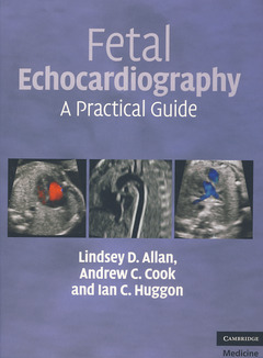 Couverture de l’ouvrage Fetal Echocardiography