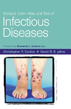 Couverture de l’ouvrage Mosby's colour atlas and text of infectious disease