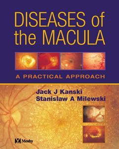 Couverture de l’ouvrage Diseases of the macula