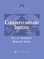 Couverture de l’ouvrage Core curriculum: cardiopulm imaging: a volume in the core curriculum series