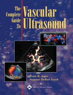 Couverture de l’ouvrage The Complete Guide to Vascular Ultrasound