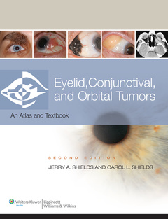 Couverture de l’ouvrage Eyelid, conjunctival, and orbital tumors (hardback): an atlas and text