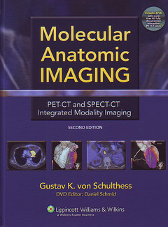 Couverture de l’ouvrage Molecular Anatomic Imaging PET-CT and SPECT-CT Integrated Modality Imaging, with DVD