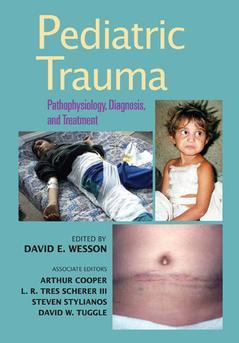 Couverture de l’ouvrage Pediatric Trauma