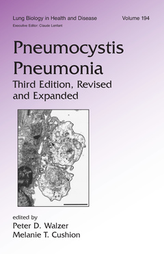 Couverture de l’ouvrage Pneumocystis Pneumonia