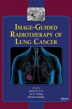 Couverture de l’ouvrage Image-Guided Radiotherapy of Lung Cancer