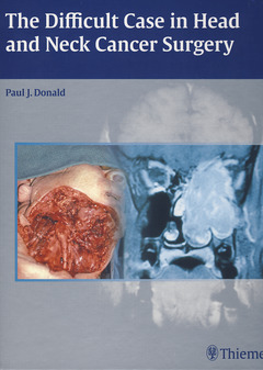 Cover of the book The difficult case in head and neck cancer surgery