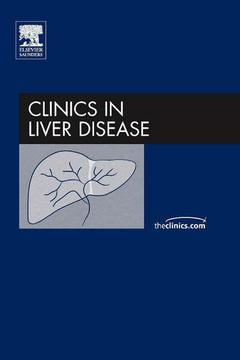 Cover of the book Alcoholic liver disease, an issue of clinics in liver disease