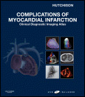 Couverture de l’ouvrage Complications of myocardial infarction: clinical diagnostic imaging atlas with DVD