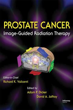 Couverture de l’ouvrage Image-Guided Radiation Therapy of Prostate Cancer