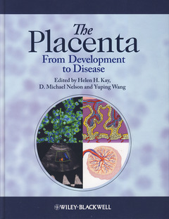Couverture de l’ouvrage The placenta: from development to disease