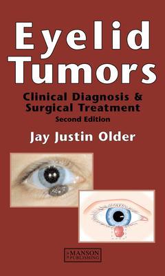 Couverture de l’ouvrage Eyelid Tumors