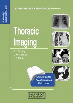 Couverture de l’ouvrage Self-assessment Colour Review of Thoracic Imaging